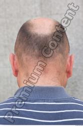 Head Hair Man Casual Slim Average Bald Street photo references